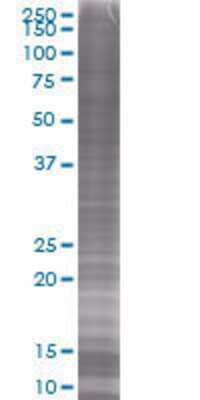 ZDHHC7 transfected lysate