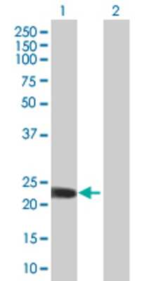 Lane 1: ZDHHC7 transfected lysate (22.99 KDa). Lane 2: Non-transfected lysate.