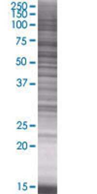 TBC1D22B transfected lysate.