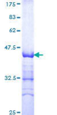 12.5% SDS-PAGE Stained with Coomassie Blue.