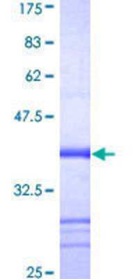 SDS-Page: Recombinant Human NLRP2/NALP2 Protein [H00055655-Q01] - 12.5% SDS-PAGE Stained with Coomassie Blue.