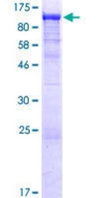 SDS-PAGE Recombinant Human Smek1 GST (N-Term) Protein