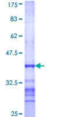SDS-Page: Recombinant Human SCYL2 Protein [H00055681-Q01] - 12.5% SDS-PAGE Stained with Coomassie Blue.