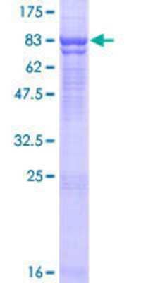 12.5% SDS-PAGE Stained with Coomassie Blue.