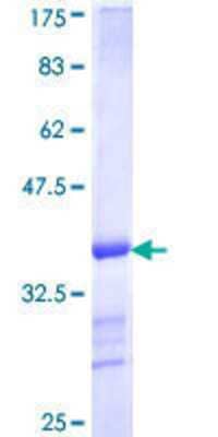 SDS-Page: Recombinant Human VPS35 Protein [H00055737-Q01] - 12.5% SDS-PAGE Stained with Coomassie Blue.