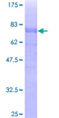 12.5% SDS-PAGE Stained with Coomassie Blue.