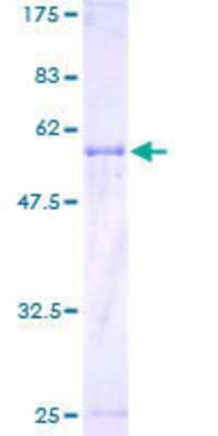 12.5% SDS-PAGE Stained with Coomassie Blue.