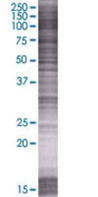 UGCGL2 transfected lysate.