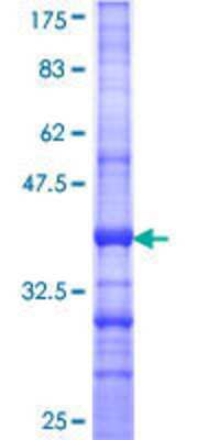 12.5% SDS-PAGE Stained with Coomassie Blue.