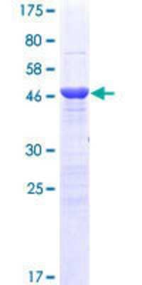 12.5% SDS-PAGE Stained with Coomassie Blue.