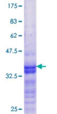 SDS-Page: Recombinant Human DEPDC1B Protein [H00055789-Q01] - 12.5% SDS-PAGE Stained with Coomassie Blue.