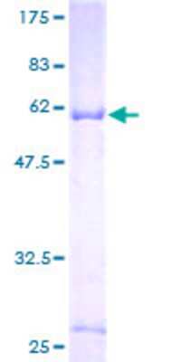 12.5% SDS-PAGE Stained with Coomassie Blue.