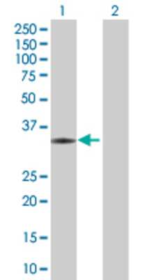 Lane 1: ChGn transfected lysate (32.78 KDa) Lane 2: Non-transfected lysate.
