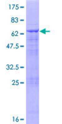 12.5% SDS-PAGE Stained with Coomassie Blue.