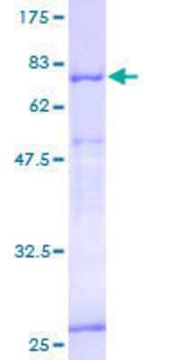 12.5% SDS-PAGE Stained with Coomassie Blue.