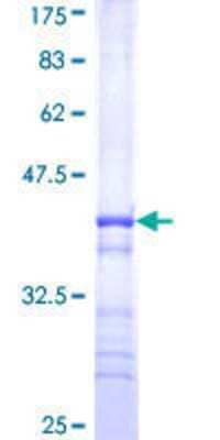12.5% SDS-PAGE Stained with Coomassie Blue.