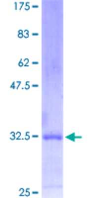 12.5% SDS-PAGE Stained with Coomassie Blue.