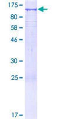 12.5% SDS-PAGE Stained with Coomassie Blue.