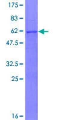 12.5% SDS-PAGE Stained with Coomassie Blue.