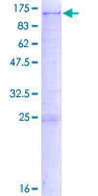 SDS-Page: Recombinant Human Sulfatase-2/SULF2 Protein [H00055959-P02] - 12.5% SDS-PAGE Stained with Coomassie Blue.