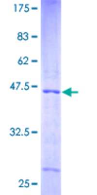 12.5% SDS-PAGE Stained with Coomassie Blue.