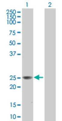 Lane 1: BCAP29 transfected lysate (28.3 KDa). Lane 2: Non-transfected lysate.