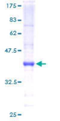 SDS-Page: Recombinant Human BarX1 Protein [H00056033-P01] - 12.5% SDS-PAGE Stained with Coomassie Blue.