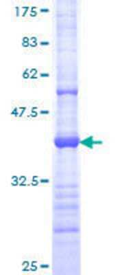 12.5% SDS-PAGE Stained with Coomassie Blue.