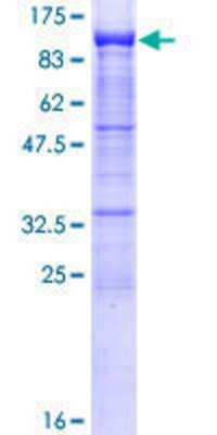 12.5% SDS-PAGE Stained with Coomassie Blue.
