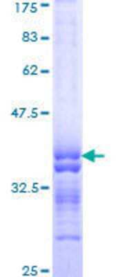 12.5% SDS-PAGE Stained with Coomassie Blue.