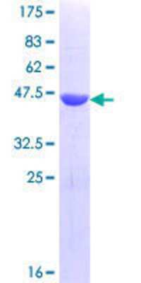 SDS-Page: Recombinant Human Tex14 Protein [H00056155-Q01] - 12.5% SDS-PAGE Stained with Coomassie Blue.