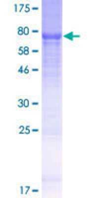 12.5% SDS-PAGE Stained with Coomassie Blue.