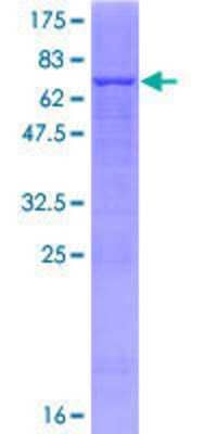 12.5% SDS-PAGE Stained with Coomassie Blue.