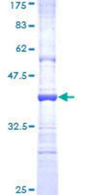 12.5% SDS-PAGE Stained with Coomassie Blue.