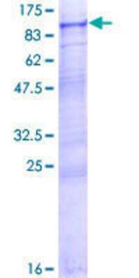 12.5% SDS-PAGE Stained with Coomassie Blue.