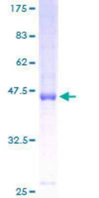 12.5% SDS-PAGE Stained with Coomassie Blue.