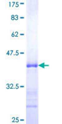 12.5% SDS-PAGE Stained with Coomassie Blue.