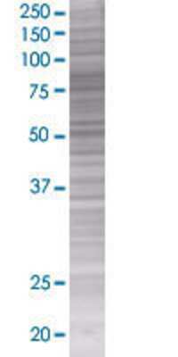 SPHK2 transfected lysate.