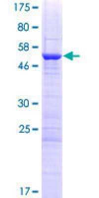 12.5% SDS-PAGE Stained with Coomassie Blue.