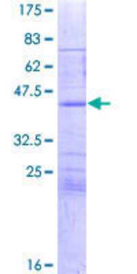 12.5% SDS-PAGE Stained with Coomassie Blue.