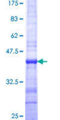 12.5% SDS-PAGE Stained with Coomassie Blue.