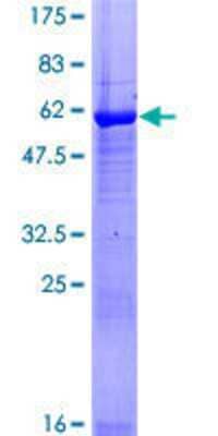 Other Recombinant Human TAK1L GST (N-Term) Protein