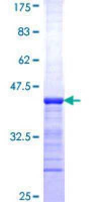 12.5% SDS-PAGE Stained with Coomassie Blue.