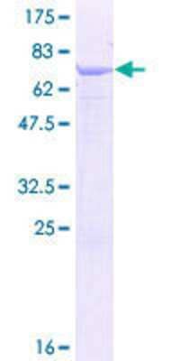 Other Recombinant Human SMYD2 GST (N-Term) Protein