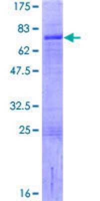 12.5% SDS-PAGE Stained with Coomassie Blue.