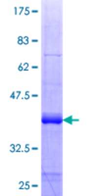 12.5% SDS-PAGE Stained with Coomassie Blue.