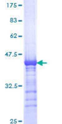 SDS-PAGE Recombinant Human KIF15 GST (N-Term) Protein