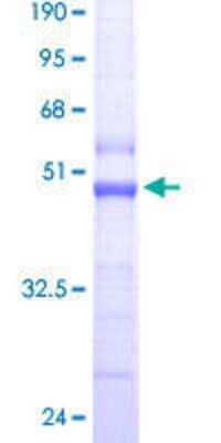 12.5% SDS-PAGE Stained with Coomassie Blue.