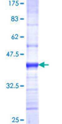 12.5% SDS-PAGE Stained with Coomassie Blue.
