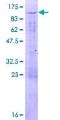 12.5% SDS-PAGE Stained with Coomassie Blue.